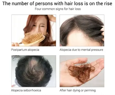 Picture of MORFOSE Milk Therapy Keratin Hair Serum - 100ml