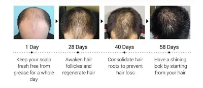 Picture of MORFOSE Milk Therapy Keratin Hair Serum - 100ml