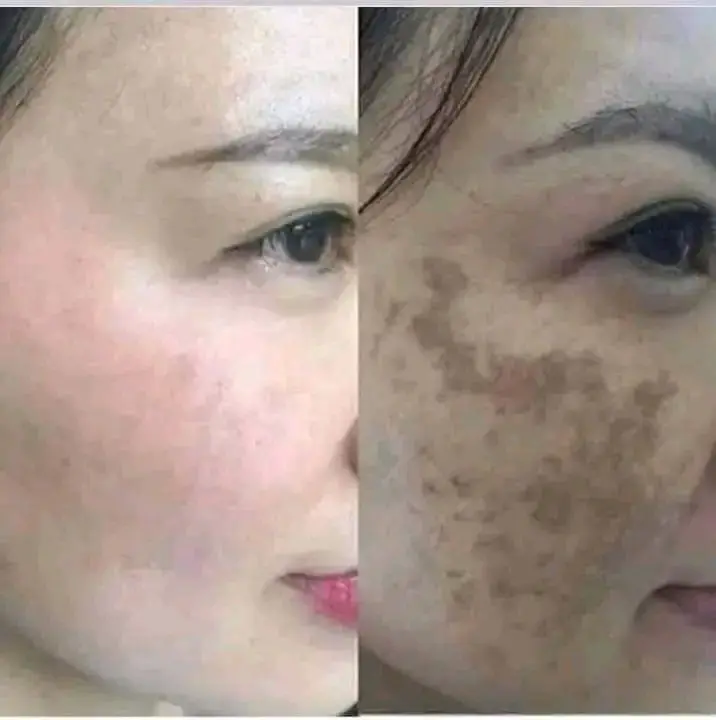 Picture of The Ordinary Niacinamide 10% + Zinc 1%-30ml