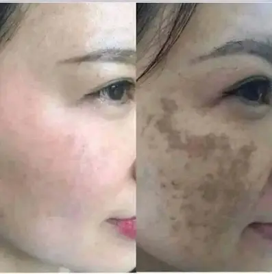 Picture of The Ordinary Niacinamide 10% + Zinc 1%-30ml