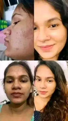 Picture of The Ordinary Niacinamide 10% + Zinc 1%-30ml