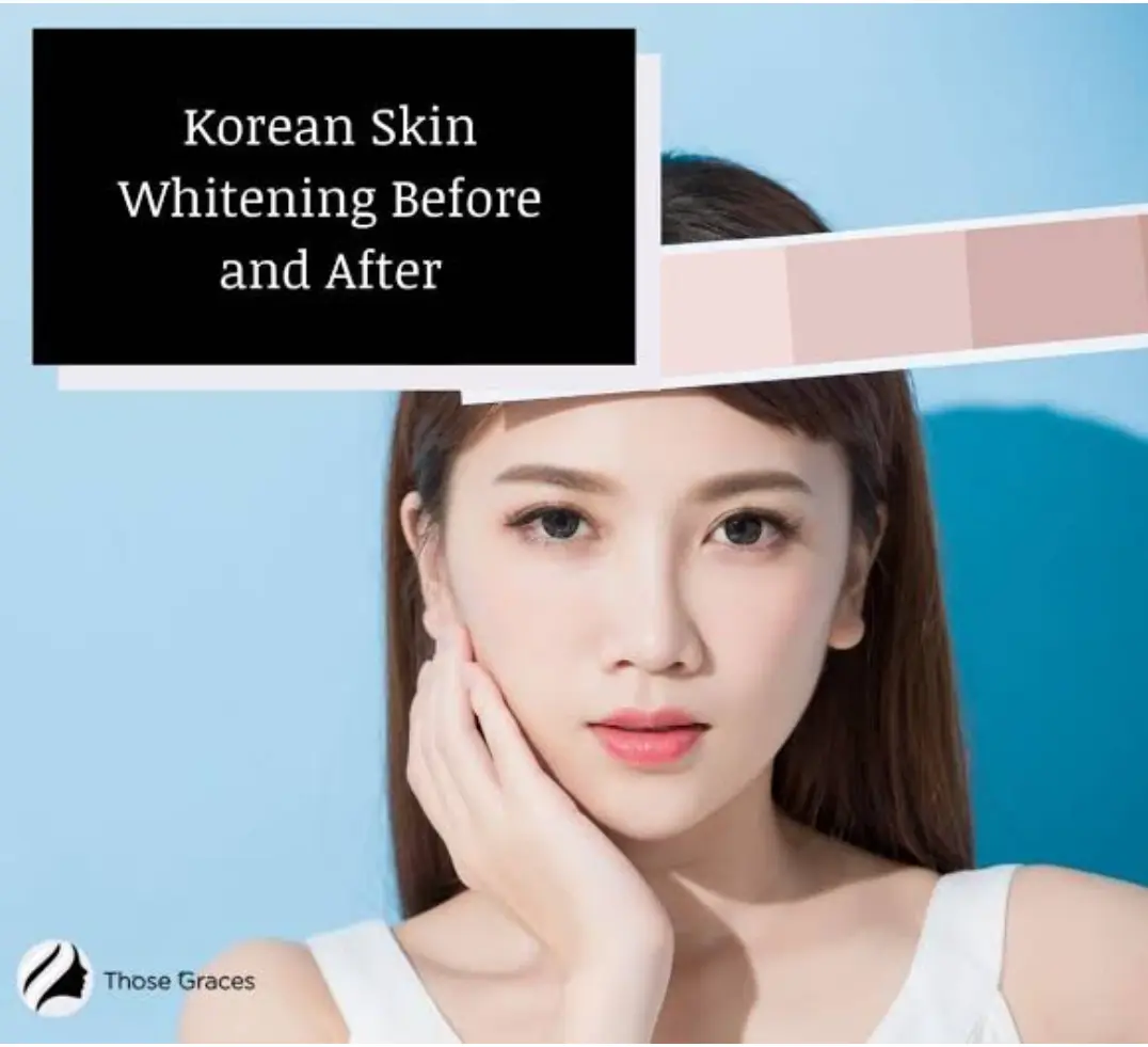 Picture of Rapid Action Whitening Cream 1 Days Whitening Challenge