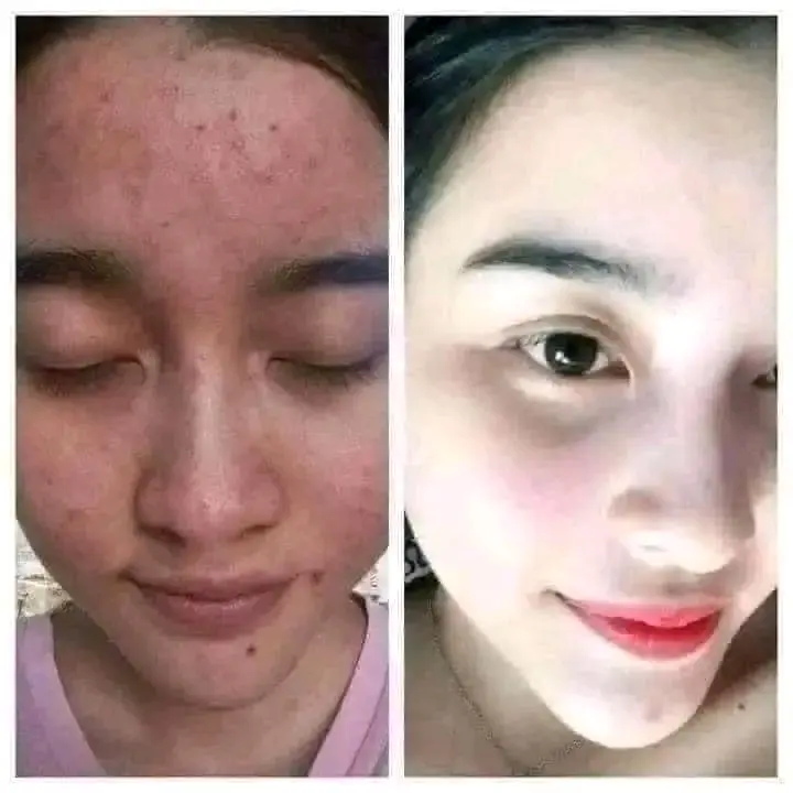 Picture of Doll Saffron Face Pack (Instant Result) - 250