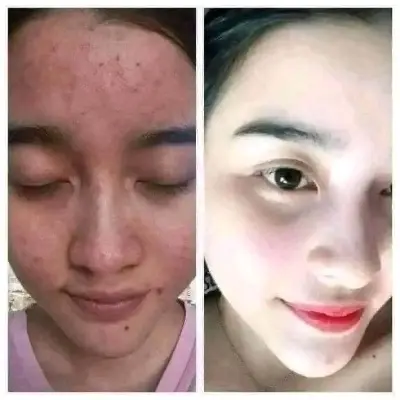 Picture of Doll Saffron Face Pack (Instant Result) - 250