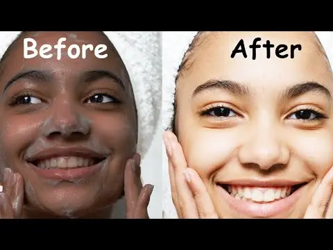 Picture of Bio Clock Emergency Whitening Night Cream - 20gm(Korea)