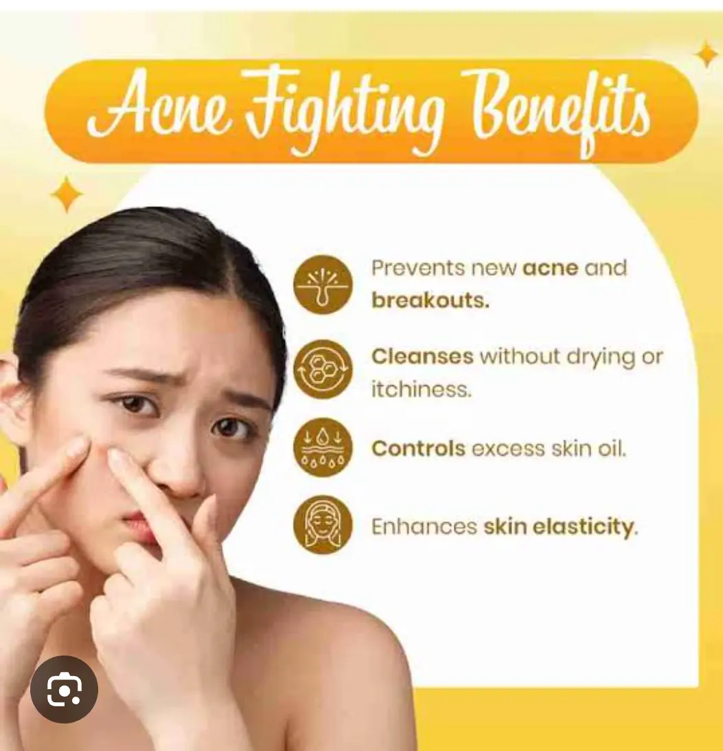 Picture of Neutrogena Oil Control Acne Wash Facial Cleanser Facewash - 80ml - Orange