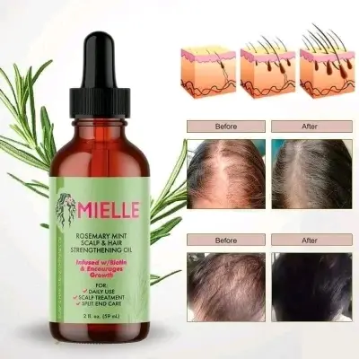 Picture of MIELLE Rosemary Mint Scalp & Hair Strengthening Oil- 59ml (USA)
