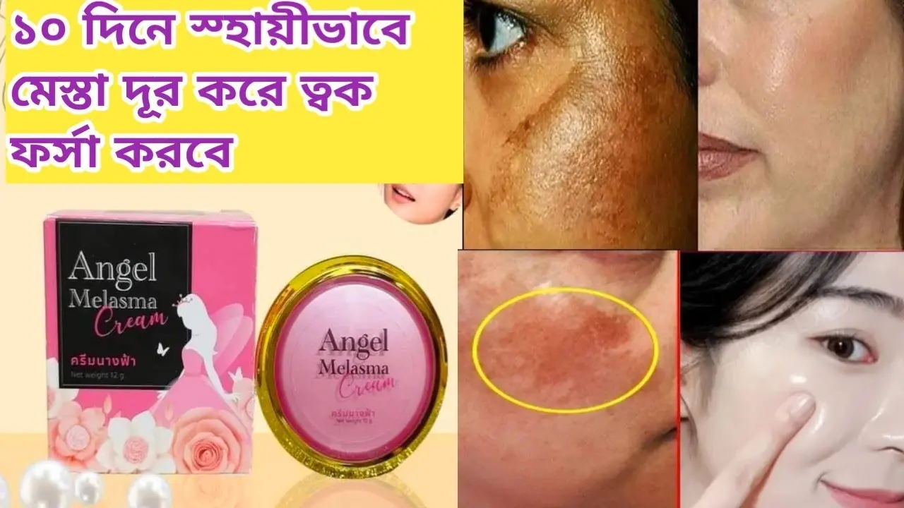 Picture of Angel Melasma Whitening Night Cream - 12gm