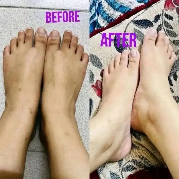 Picture of Kem Cot Thai Emergency Whitening Body Cream - 300gm