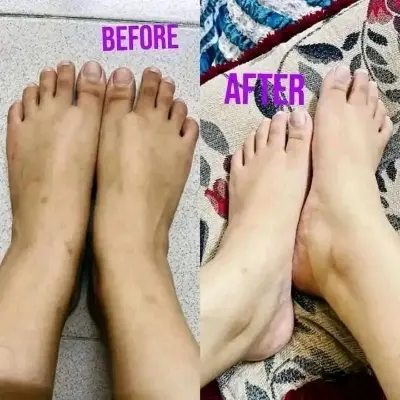 Picture of Kem Cot Thai Emergency Whitening Body Cream - 300gm