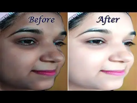 Picture of Kem Cot Thai Emergency Whitening Night Cream