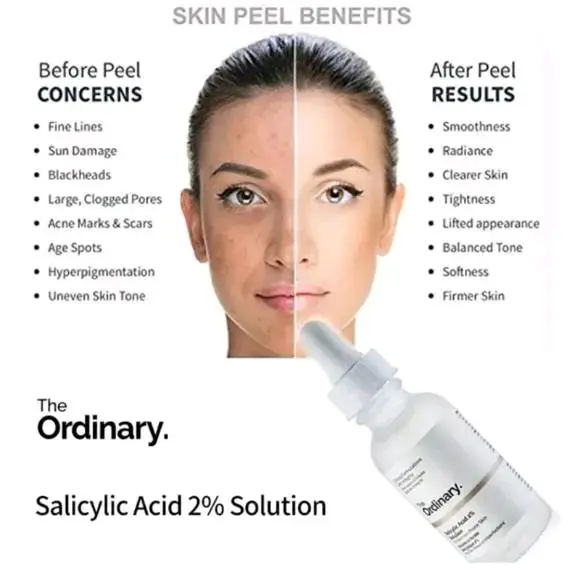 Picture of The Ordinary Salicylic Acid 2% Solution Serum