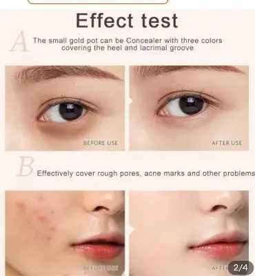 Picture of Sweet Mint Conceal Tri -Colour Concealer Palette Of Covers Acne Marks Dark Circles