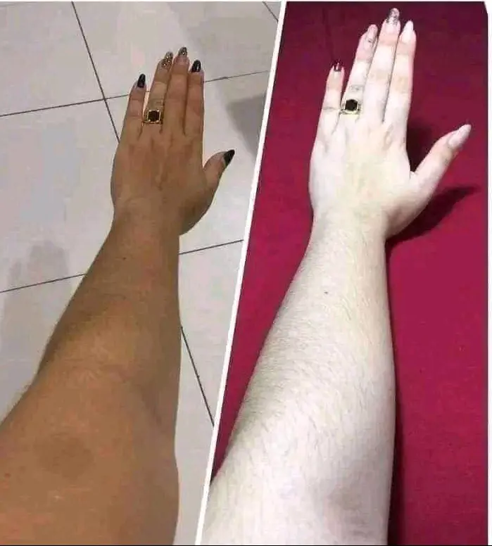 Picture of Aceso Full Face & Body Whitening Combo