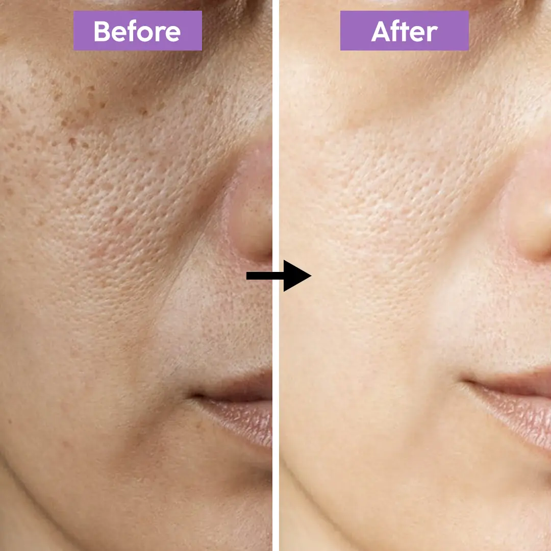 Picture of Gluta Collagen Pink Emergency Whitening Night Cream