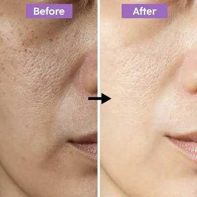 Picture of Gluta Collagen Pink Emergency Whitening Night Cream