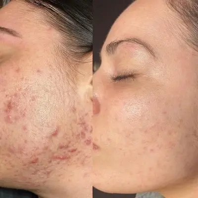 Picture of Original Dr. Althea 345 Relief Cream 50ml (Korea)