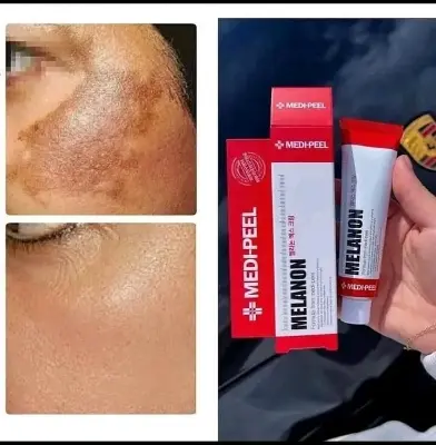 Picture of 𝐌𝐄𝐃𝐈-𝐏𝐄𝐄𝐋 𝐌𝐞𝐥𝐚𝐧𝐨𝐧 𝐗 𝐂𝐫𝐞𝐚𝐦 - 𝟑𝟎𝐦𝐥