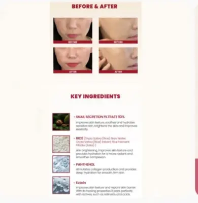 Picture of Seoul 1988 Cream : Snail Mucin 93%+ Rice