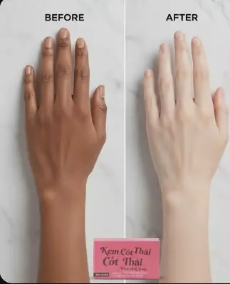 Picture of Kem Cot Thai Whitening Soap