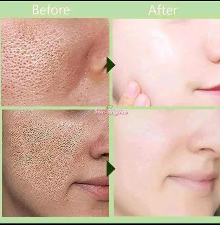 Picture of Celebrity Glow Skin Glutathione Super Whitening Combo Set (Soap,Day Cream,night cream)