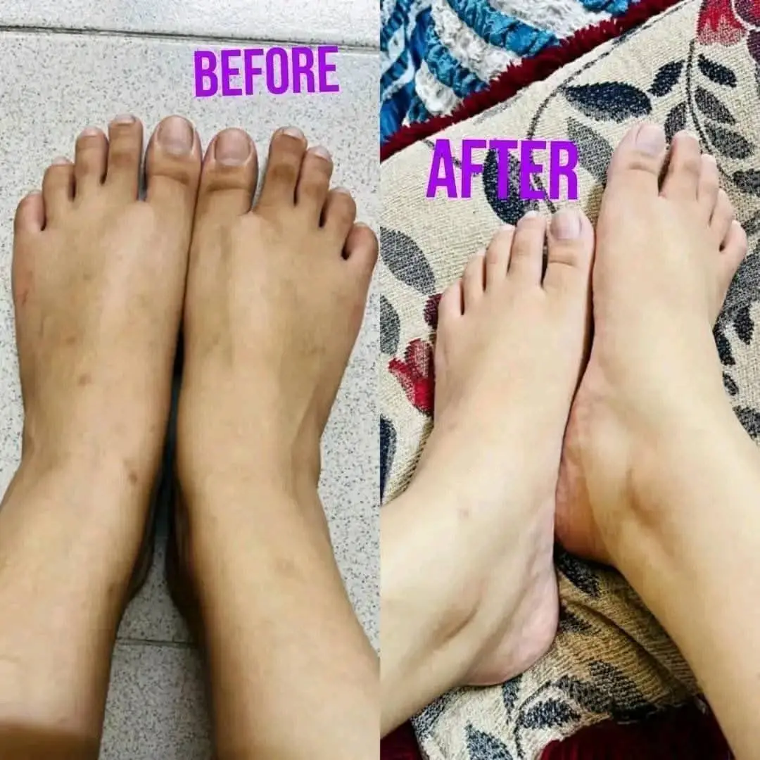 Picture of Authentic Kem Cot Thai Whitening Body Cream