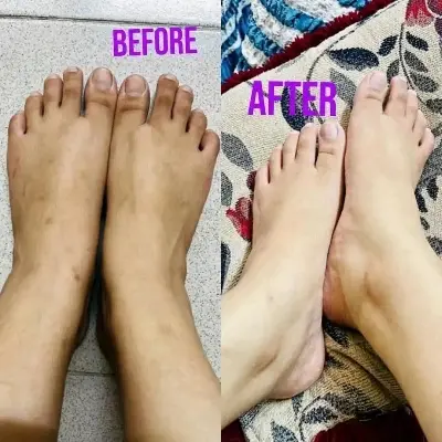 Picture of Authentic Kem Cot Thai Whitening Body Cream