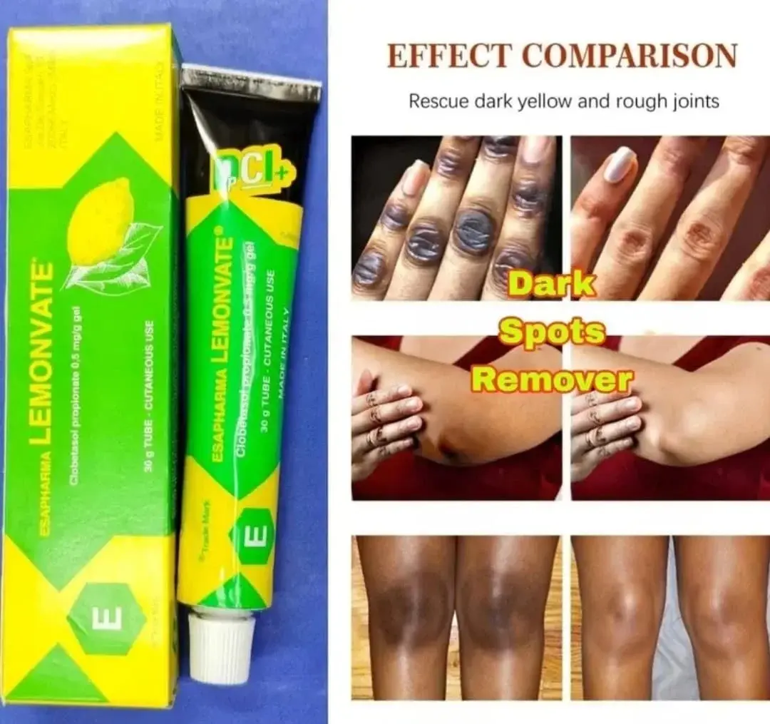 Picture of Esapharma LemonVate Cream For Skin Whitening 30g