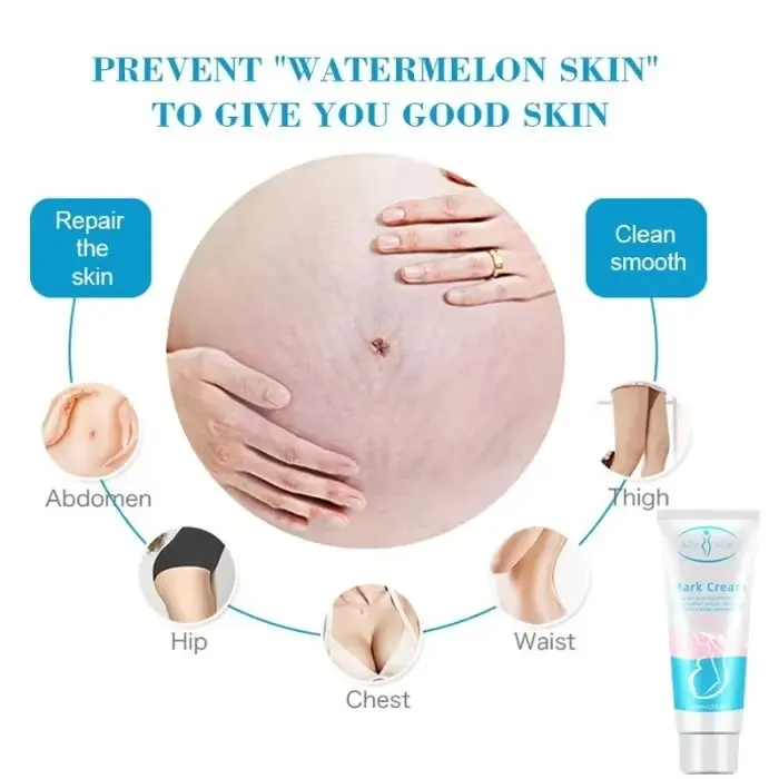 Picture of Aichun Beauty Anti-Stretch Marks Cream | Stretch Marks Removal Cream 60gm