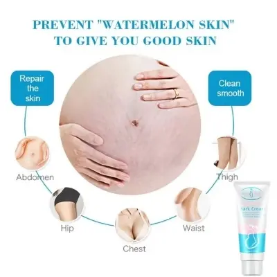 Picture of Aichun Beauty Anti-Stretch Marks Cream | Stretch Marks Removal Cream 60gm