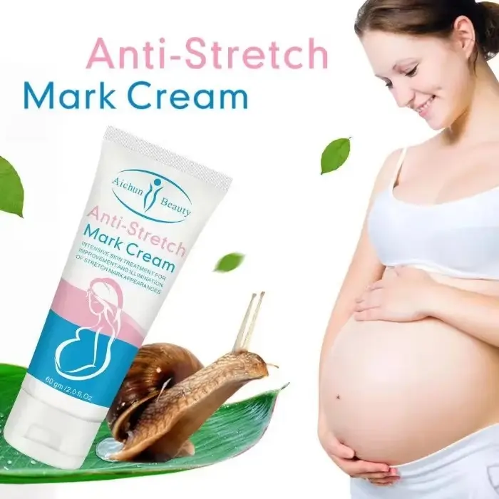 Picture of Aichun Beauty Anti-Stretch Marks Cream | Stretch Marks Removal Cream 60gm