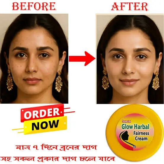 Picture of Glow Herbal Fairness cream