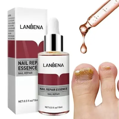 Picture of LANBENA Nail Repair Essence Serum Fungus Treatment Nail Removal Onychomycosis-15ml