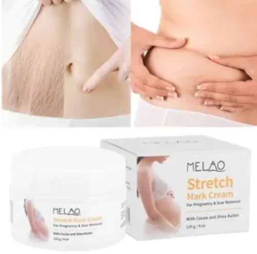 Picture of MELAO Women Remove Pregnancy Scars Acne Cream Stretch Marks Treatment Maternity Repair Anti-Aging Body Creams-120gm