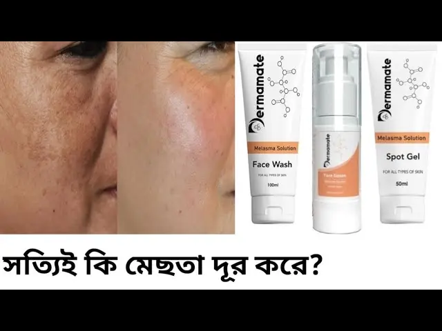 Picture of Dermamate Melasma Solution face wash 100ml