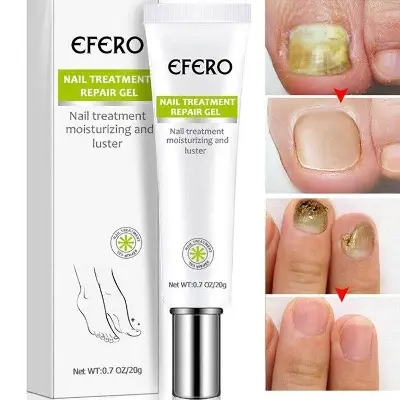 Picture of Efero Nail Repair Treatment Gel Fungus Cream-20gm Efero Nail Repair Treatment Gel Fungus Cream-20gm