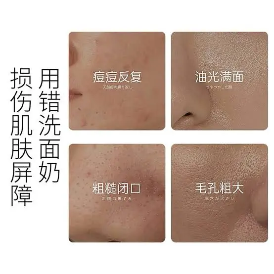 Picture of OSUFI Vitamin B5 Salicylic Acid Brighten Deep Cleansing Pores Melanin Removal Oil Control Moisturizing Gentle Face Wash Skincare