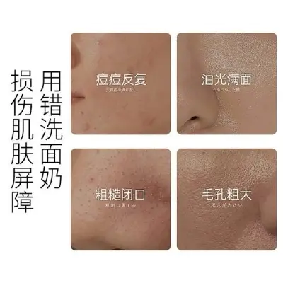 Picture of OSUFI Vitamin B5 Salicylic Acid Brighten Deep Cleansing Pores Melanin Removal Oil Control Moisturizing Gentle Face Wash Skincare