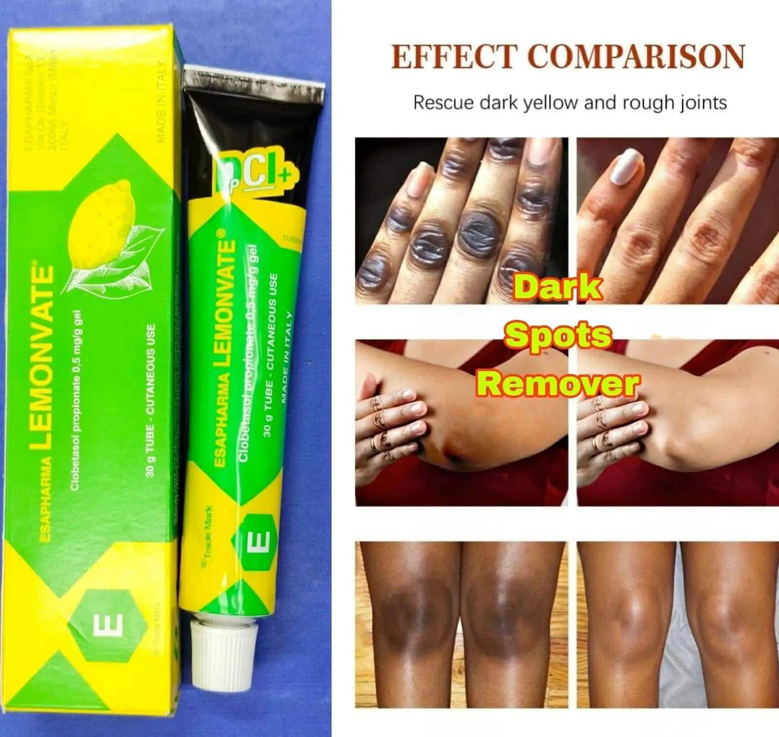 Picture of Lemonvate Cream - 30gm (Italy)