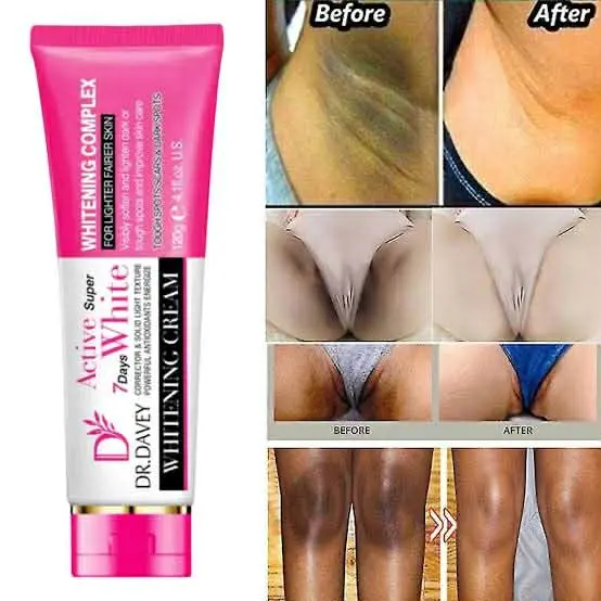 Picture of DR.DAVEY Body & Privet part Super Whitening Cream 120gm
