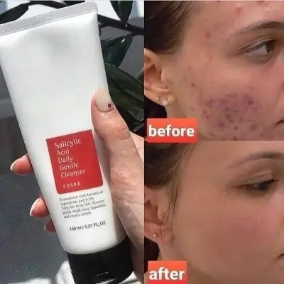 Picture of COSRX Salicylic Acid Daily Gentle Cleanser - Face Wash-150ml