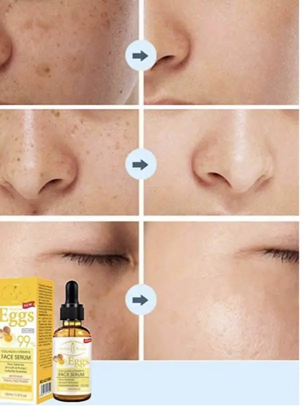 Picture of Aichun Beauty Face Serum Eggs Collagen + Vitamin E -30ml