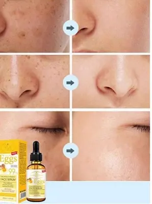 Picture of Aichun Beauty Face Serum Eggs Collagen + Vitamin E -30ml