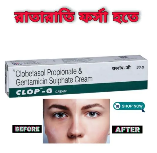 Picture of 2pic Clobetasol Clop-G Cream 30gm indian