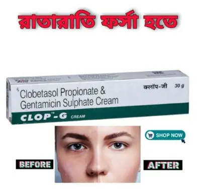 Picture of 2pic Clobetasol Clop-G Cream 30gm indian