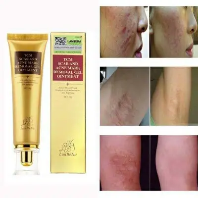 Picture of LANBENA TCM scar and Acne Spot Removal Gel Ointment