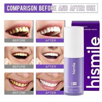 Picture of Hismile V34 Purple Color Corrector Teeth Toothpaste Effective Whitening Teeth Mousse Oral Cleaning Whitening Toothpaste Product