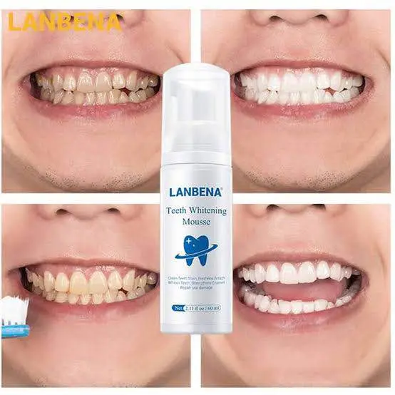Picture of LANBENA Teeth Whitening Mousse (60ml) Rich & Delicate Foam - Clean Teeth Stain, Freshen Breath, Whiten Teeth, Strengthen Enamel, Repair Oral Damage