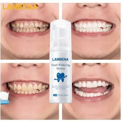 Picture of LANBENA Teeth Whitening Mousse (60ml) Rich & Delicate Foam - Clean Teeth Stain, Freshen Breath, Whiten Teeth, Strengthen Enamel, Repair Oral Damage