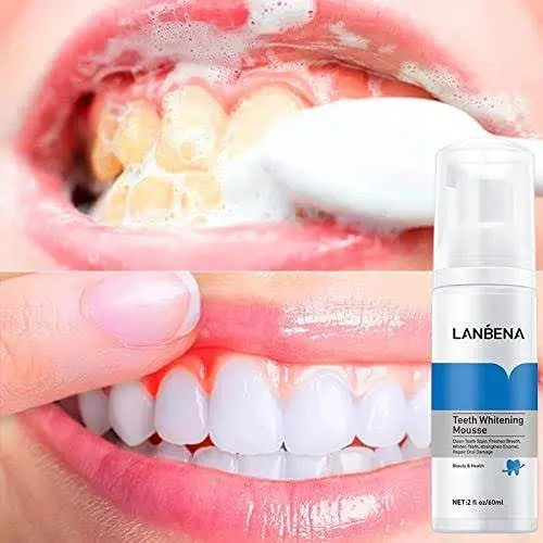 Picture of LANBENA Teeth Whitening Mousse (60ml) Rich & Delicate Foam - Clean Teeth Stain, Freshen Breath, Whiten Teeth, Strengthen Enamel, Repair Oral Damage